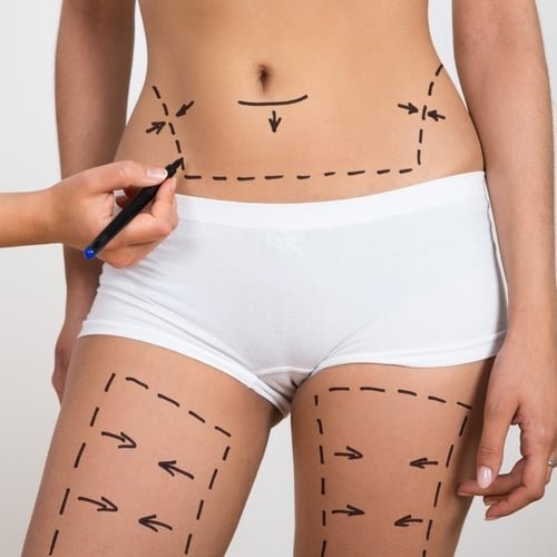 Drenagem Pós-operatória